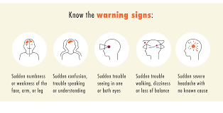 Image result for Aphasia