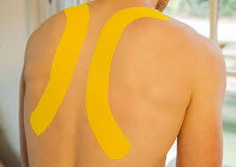 Nieuwe voorraad tape is weer binnen. Medical Taping Ook Effectief Bij Hooikoorts Mecebi