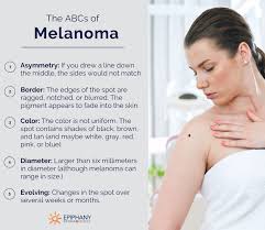 Skin cancer affects millions of. How To Tell The Difference Between Skin Tags Moles Warts