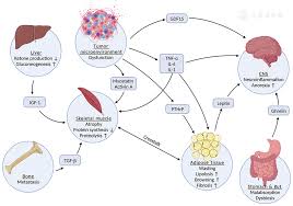Image result for Cachexia in Cancer