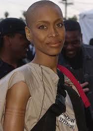 Black women in particular are prone to a type of hair loss called traction alopecia, which is caused by heat, chemicals and tight styles that pull at the hair root, including some braids, dreadlocks, extensions and weaves. Five Things I Love About Erykah Badu S Style Woman Shaving Bald Women Short Hair Styles