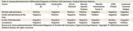 Residents and fellows contest rules | international ophthalmologists contest rules. Merkel Cell Carcinoma Treatment Pdq Health Professional Version National Cancer Institute