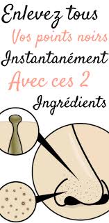 Comment Enlever Les Points Noirs Du Nez En 15 Min Diy Beauty Hacks Homemade Cosmetics Diy Cosmetics