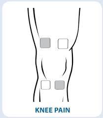 Tens Unit Electrode Placement Guide Prohealthcareproducts Com