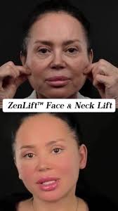 Signature Lift Vs O2 Lift Facial