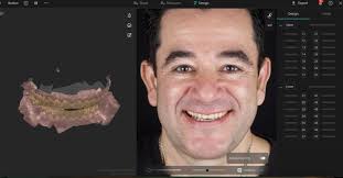 Mais novas atualizações do @smilecloud_biometrics ! O 3DNA vem pra integrar  tudo, ser simples, intuitivo e genial, assim como seu criador @florincofar  ! Agora podemos ver tudo no modo HD com alta ...