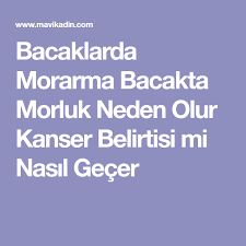 Bacaklarda Morarma Bacakta Morluk Neden Olur Kanser Belirtisi Mi Nasil Gecer Tig Desenleri Desenler Bacaklar