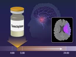 Image result for Tenecteplase