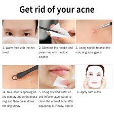 Feb 08, 2019 · start by cleansing your skin with warm water, says dr. Garosa Comedone Remover Needle 3pcs Box Acne Remover Tool Stainless Steel Blackhead Blemish Pimple Extractor Removal Needle Pimple Remover Needle Walmart Canada
