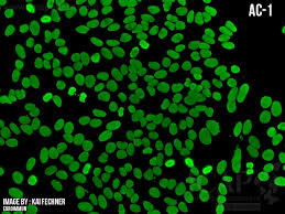 Image result for ANA Staining Pattern