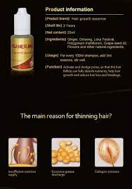 It can have a lot to do with what the cause of the hair loss is as well as just the individual's resistance or tolerance to certain types of products or ingredients within the products. 20ml 100 Natural Ginger Hair Growth Essential Oil Liquid Hair Loss Products Leave In Hair Scalp Treatments For Hair Care Sanbro Store