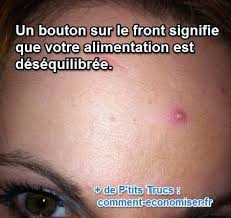 Bouton Sur Le Front Alimentation Trop Riche Et D Eacute S Eacute Quilibr Eacute E Acne
