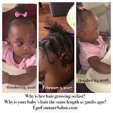 Your transplanted follicles will start to grow within a weeks time ( 5 to 7 days ). How To Get Your Baby S Hair To Grow Real Hair Talks