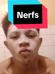 God Nerfed Me with Acne