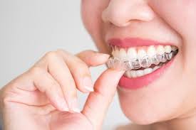 A Smiling Woman Holding Invisalign Or In Premium Photo Freepik Photo Woman Beauty Health Smile In 2020 Invisalign Orthodontics Invisible Braces