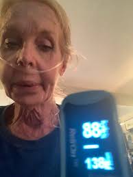 I've had pulmonary disease for years from LATEX ALLERGY when we had to  start wearing gloves in the OR (about '85-87). I've got something awful  right now,