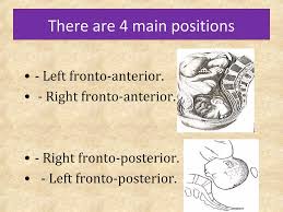 Image result for Shoulder Presentation
