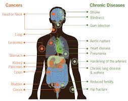 For each health topic, you'll find a basics version, which provides essential what are autoimmune diseases? Cdc Vital Signs Tobacco Use Smoking Infographic