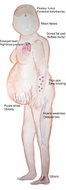 Maybe you would like to learn more about one of these? Losing Weight Lifestyletipsforgirls