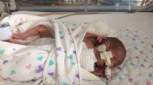 We did not find results for: Begini Cara Pencegahan Air Ketuban Sedikit Seperti Yang Dialami Aura Kasih