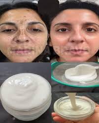 Disminuye las a rrugas y man chas de tu cara en solo 7 noc hes, aplicando  la mascarilla de BICARBONATO, mira como se hace y aprende aplicartela de la  manera correcta