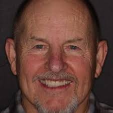 Invisalign Encinitas CA