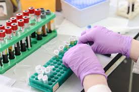 Reprezentanţii statului major al armatei naţionale neagă existenţa cazurilor de corupţie. ComplicaÈia GravÄ Care Te Poate Duce La DializÄ Ce Faci DupÄ Diagnosticare