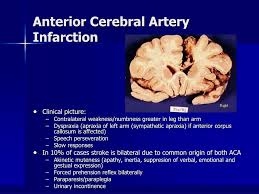 Both circulations are connected by the posterior communicating arteries (pcom), which make up the. Ppt Stroke Powerpoint Presentation Free Download Id 172025