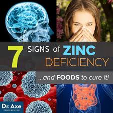 Zinc deficiency can be treated by eating foods rich in protein, meats, seafood, dairy products and nuts. 7 Signs Of Zinc Deficiency And Foods To Cure It Www Draxe Com Health Holistic Natural Womaneasy Com