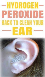 This Is The Best Hydrogen Peroxide Hack I Ve Ever Seen Lucky To Have Found This Cleaning Your Ears Cleaning Ears With Peroxide Hydrogen Peroxide Ear Cleaning