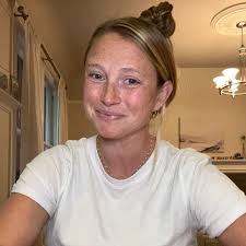 Amazon.com: Beef Tallow for Skin, Whipped Tallow and Honey Balm, Organic  Grass-Fed Beef Tallow with Raw Honey & Beeswax Natural Moisturizer for Face  & Body, Nourish and Soothe Sensitive, Dry Skin :