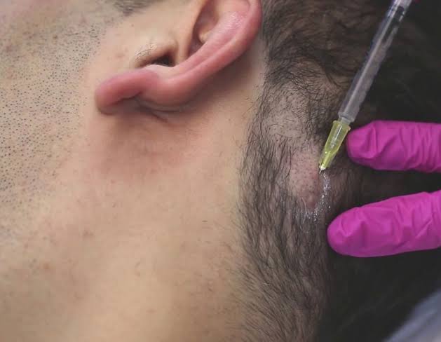 G-cell - Pro Age Clinic - UAE