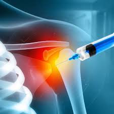 Image result for Shoulder Injection