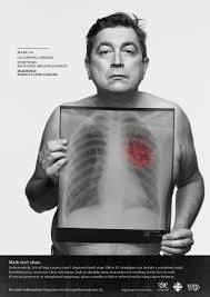 Primary symptoms of lung cancer are usually easily identified. Egfr Positive Uk On Twitter This Is Mark Diagnosed With Stage Iv Lung Cancer At 49 An Occasional Social Smoker Our See Through The Symptoms Campaign With Ukalk1 Ruthstraussfdn Raises