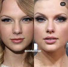 Right now we are going to list through all of taylor swift's speculated plastic surgeries, including her more obvious changes with her nose . Taylor Swift New Nose Plastic Surgery Bad Celebrity Plastic Surgery Nose Plastic Surgery