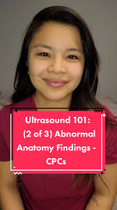 Understanding Choroid Plexus Cysts in Ultrasound: What You Need to Know