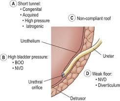 Urinary Tract Infections And Vesicoureteral Reflux Obgyn Key