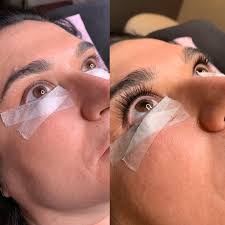 Allison Melton Aesthetics