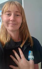 Can I run with a thumb fracture?