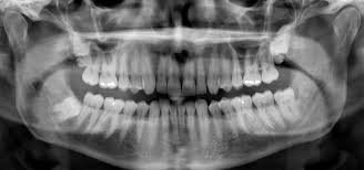 Check spelling or type a new query. Radiologi Rs Ortopedi Prof Dr R Soeharso Surakarta