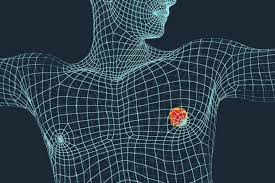 Male breast cancer is a rare cancer that forms in the breast tissue of men. Men Can Also Get Breast Cancer Pay Attention To The Symptoms World Today News