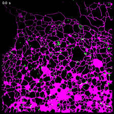 If the golgi didn't exist, cellular proteins would exist without direction. The Key To Fighting Off Parkinson S Alzheimer S Als Could Be The Tiny Speedy Lysosome