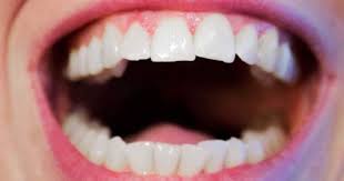 Sabes Por Que Se Tuercen Los Dientes Centauro