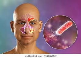 Image result for Pseudoeriosema