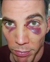 Jack Coombes's Instagram, Twitter & Facebook