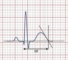 Qt Interval Wikipedia