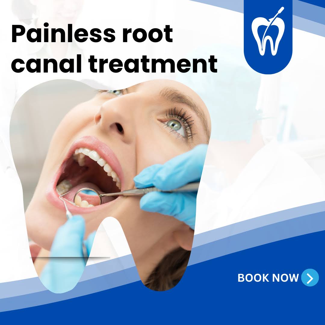 Painless Root canal treatment product image