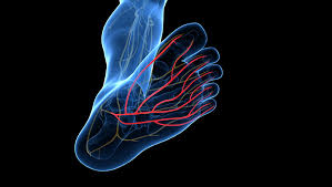 Image result for Peripheral Neuropathy