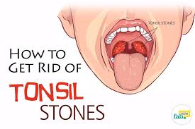 Pin On Beauty Health Tips