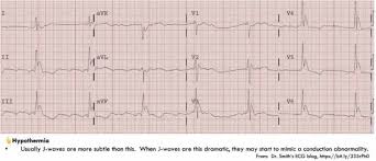 Image result for J Wave